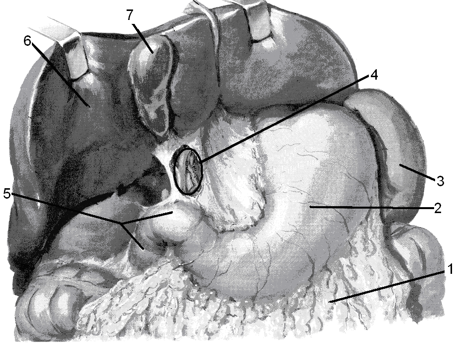 Отношение поджелудочной железы к брюшине экстраперитонеальное